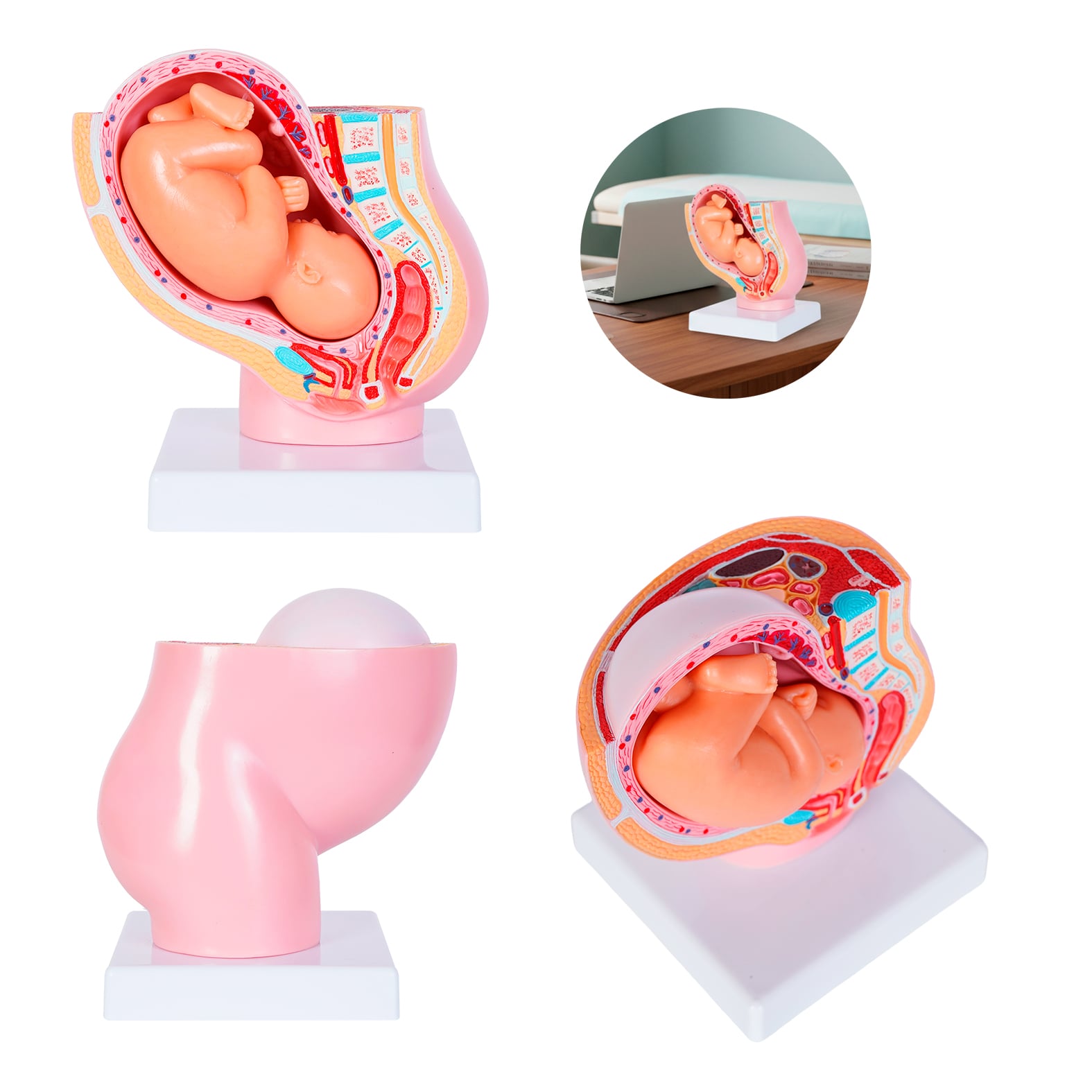 MODELO PVC SACNOFT